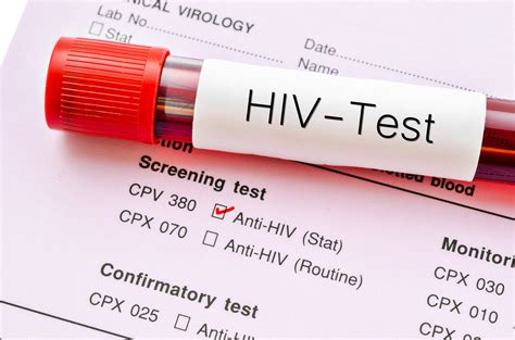 Free HIV tests at Walgreens: most adults below 64 have never tested